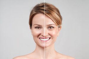 botox in odessa and midland