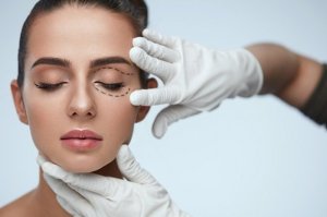 woman preparing for blepharoplasty (eyelid surgery)